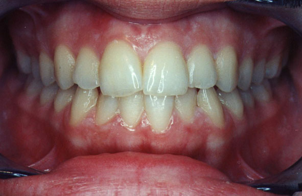 foto-odontologia-4