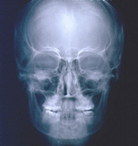radiografia-digital-1