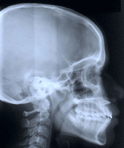 radiografia-digital-2