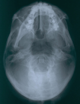 radiografia-digital-3