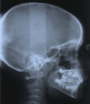 radiografia-digital-4